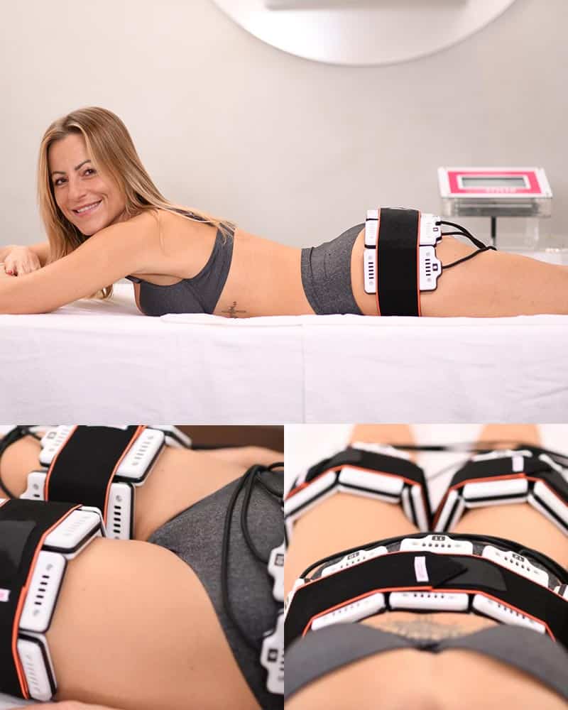 Frau während einer SlimStyler-Anwendung mit elektromagnetischen Applikatoren zur gezielten Körperformung und Muskelstimulation.